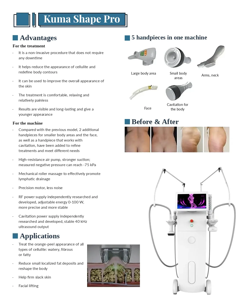 KumaShape V-shape Pro technical brochure