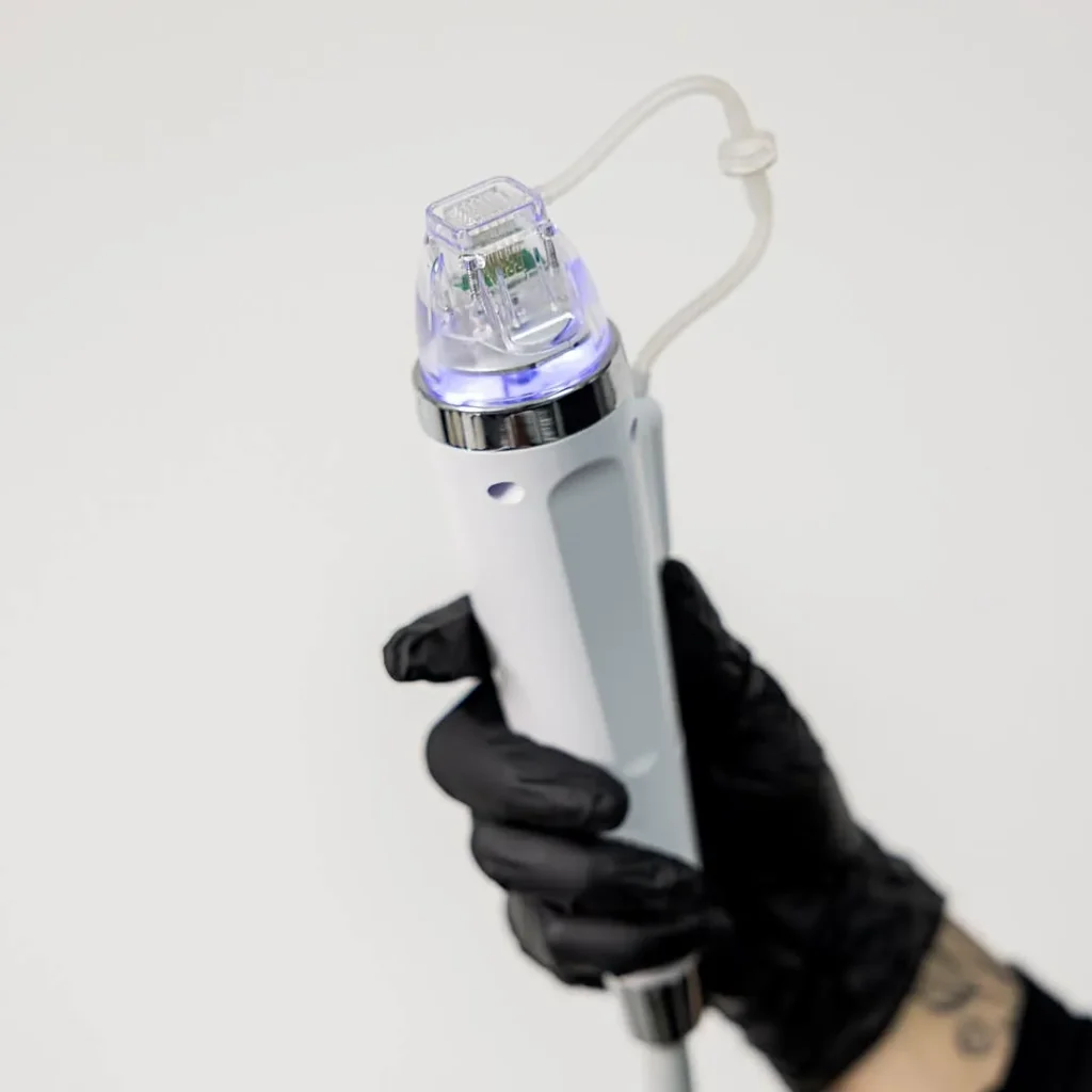 Pièce à main de microneedling professionnel tenue en main avec embout de traitement pour le visage