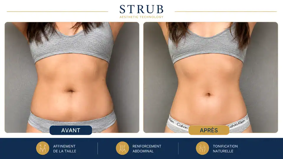 Before and after non-invasive body contouring with a slimmer waist and firmer abdomen