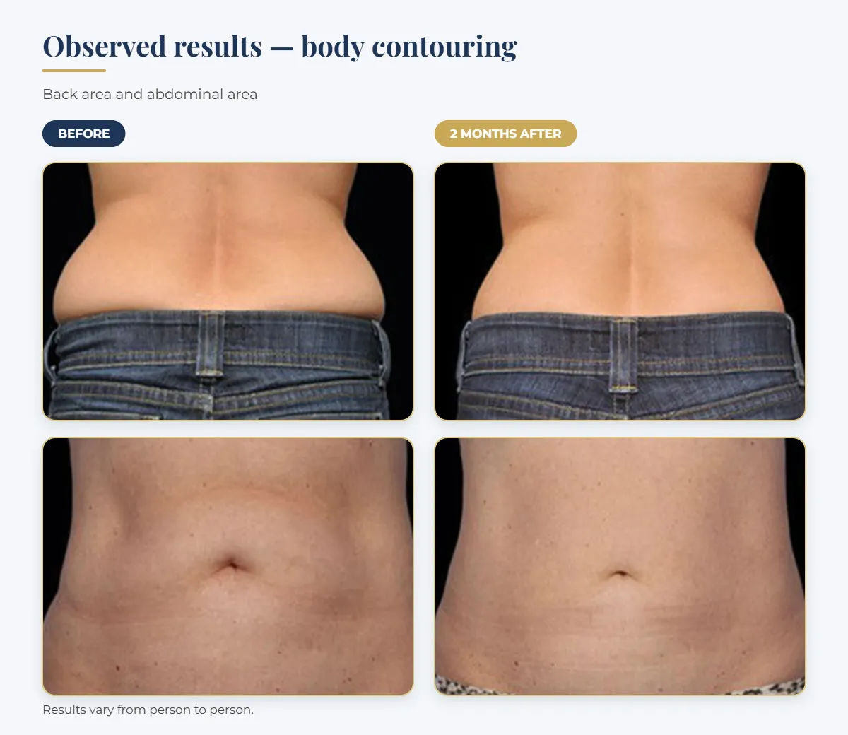 Before and 2 months after comparison of the back and abdomen: observed results of a body contouring treatment